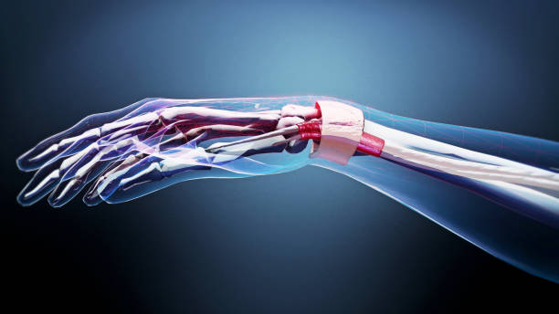 Hand and Wrist Surgery