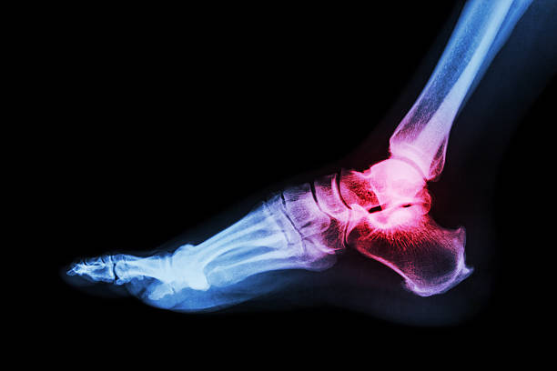 Foot and Ankle Surgery
